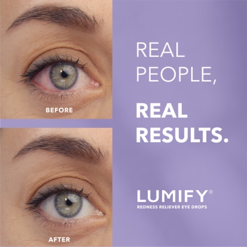 LUMIFY Redness Reliever Eye Drops Brimonidine Tartrate Ophthalmic Solution 0.025% Perspective: back