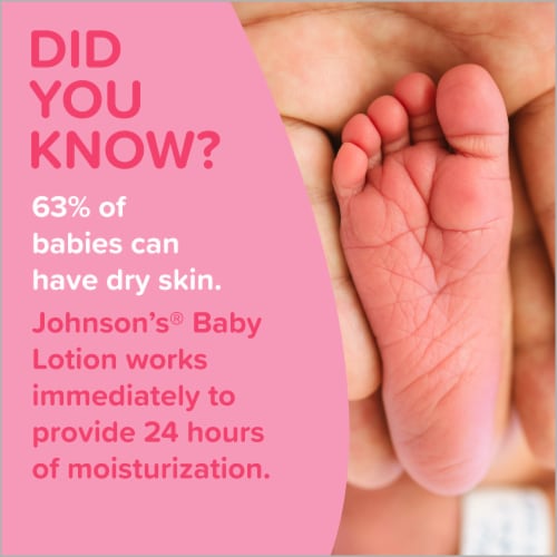 Johnson's Baby Lotion - Gentle and Mild for Delicate Skin and