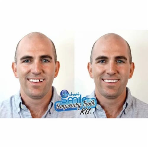 Billy Bob Teeth Inc. Instant Smile® Complete Your Smile™ Tooth Replacement Kit Perspective: back