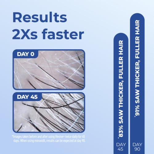 Bosley® MD Revive+ Densifying Hair Growth Foam For Men Perspective: back