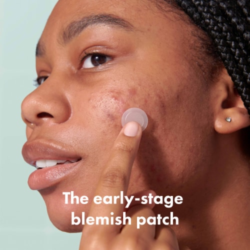 Hero Cosmetics Micropoint Mighty Patch For Blemishes Perspective: back