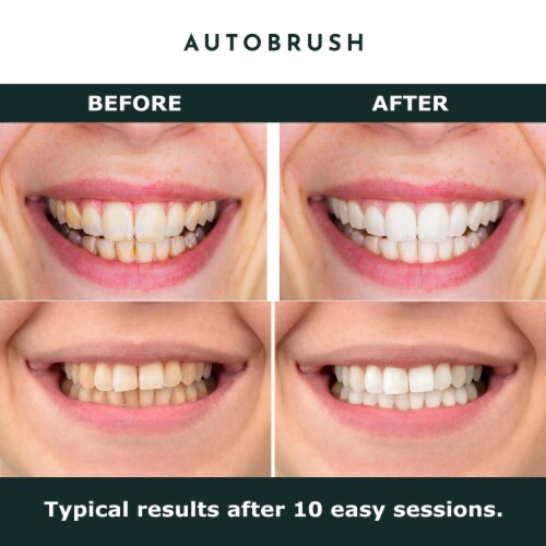 AutoBrush Whitening Kit and Oral Care System | Dental-Grade Blue Light System (Black) Perspective: back