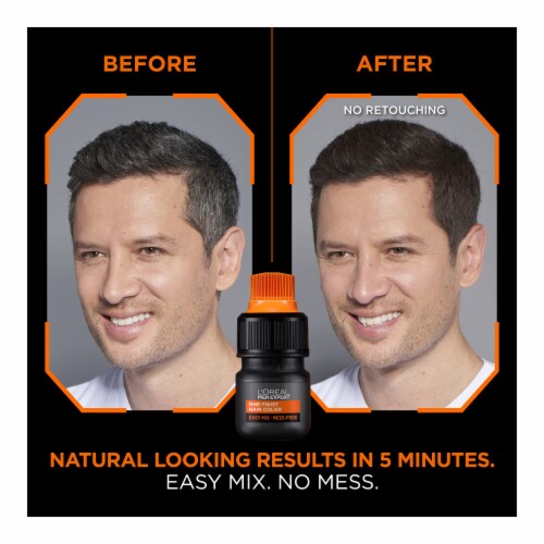 L'Oreal Paris Men Expert Dark Brown 03 Permanent Haircolor Perspective: back