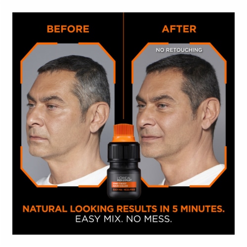 L'Oreal Paris Men Expert Medium Brown 04 Permanent Haircolor Perspective: back