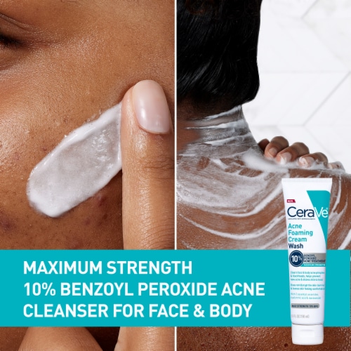 CeraVe Acne Foaming Cream Wash with 10% Benzoyl Peroxide, Gentle Face & Body Wash Acne Treatment Perspective: back