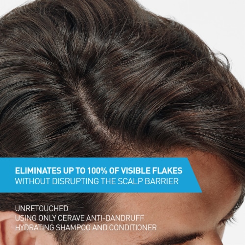 CeraVe Hydrating Anti-Dandruff Shampoo, Fragrance Paraben & Sulfate Free Shampoo For All Hair Types Perspective: back