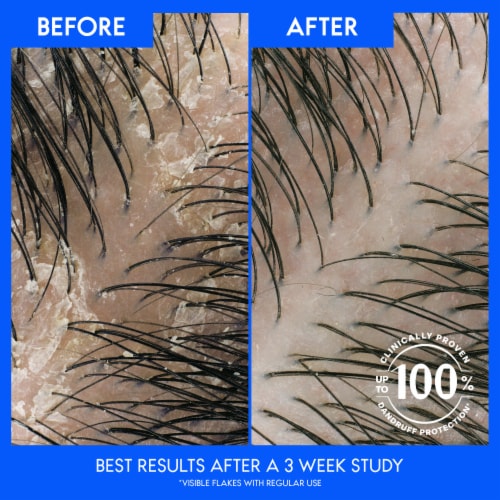 Head and Shoulders 2 in 1 Dry Scalp Care Dandruff Shampoo and Conditioner Perspective: bottom