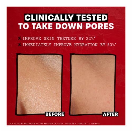 Thayers Natural Remedies Witch Hazel Toner Alcohol Free Unscented Perspective: bottom