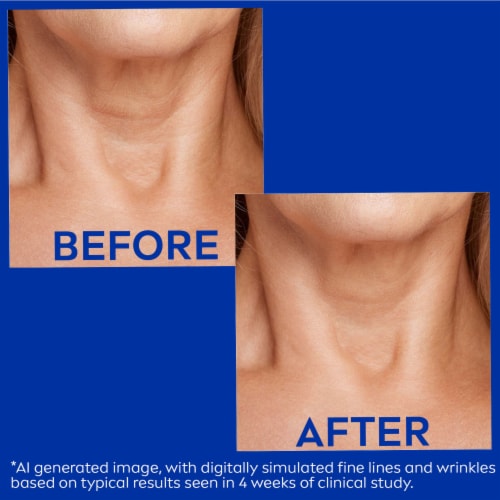 Nivea Skin Firming And Anti Wrinkle Neck And Chest Cream With Q10, Creatine And Provitamin B5 Perspective: bottom