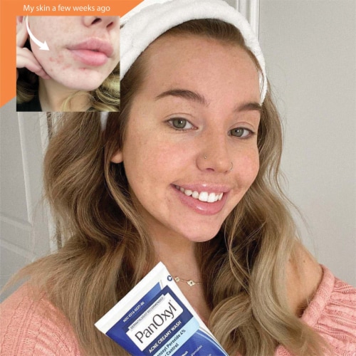 Panoxyl® Face & Body Acne Creamy Wash 4% Benzoyl Perozide Gentle PH Balanced Perspective: bottom