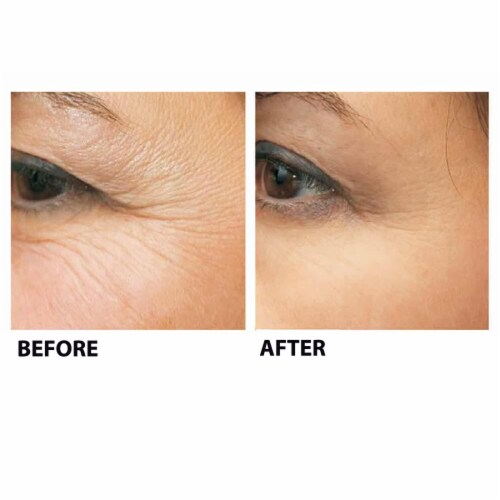 Stem Cell Therapy by BioLogic Solutions (1 oz.) Perspective: bottom
