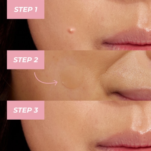 MCoBeauty® Miracle Pimple Patches Perspective: bottom