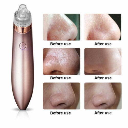 Pore suction cleaner discount