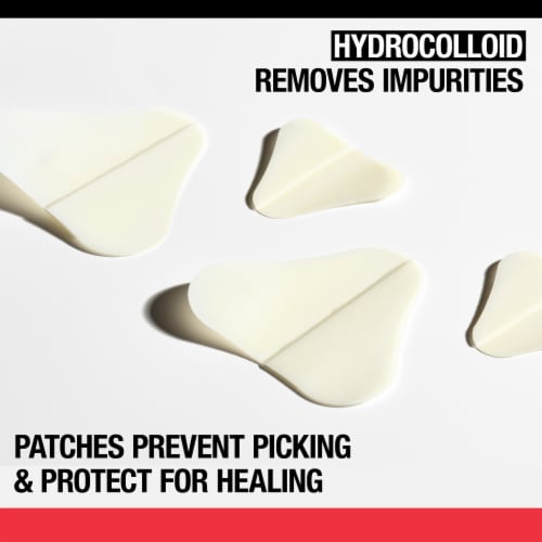 Neutrogena Stubborn Acne Pimple Patches Provide Optimal Healing Enviroment for Pimples Perspective: left
