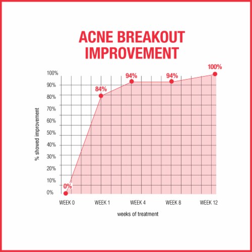 Neutrogena Stubborn Acne AM Face Treatment with 2.5% Micronized Benzoyl Peroxide Acne Medication Perspective: left