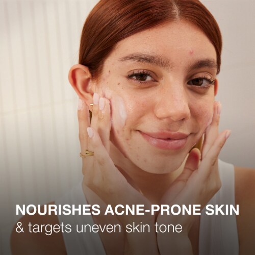 Neutrogena Ultra Gentle Face Gel Hydrator (Pack of 4) Perspective: left