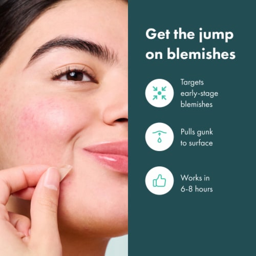 Hero Cosmetics Micropoint Mighty Patch For Blemishes Perspective: left