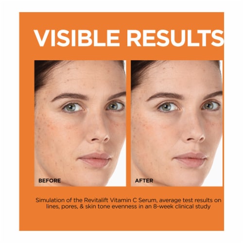L'Oreal Paris Revitalift 2 percent Pure Vitamin C E Salicylic Acid Serum Perspective: left