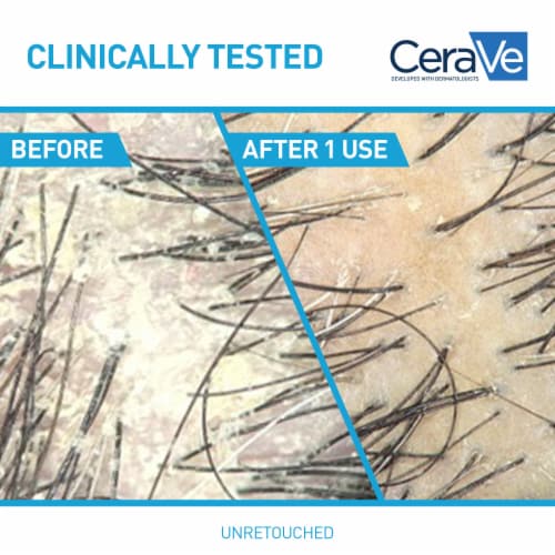 CeraVe Hydrating Anti-Dandruff Shampoo, Fragrance Paraben & Sulfate Free Shampoo For All Hair Types Perspective: left