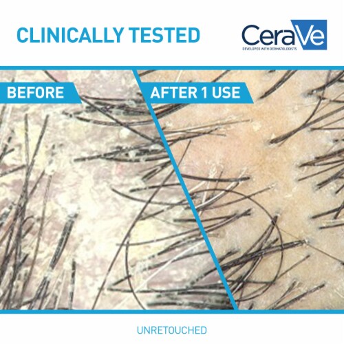 CeraVe Hydrating Anti-Dandruff Conditioner, Fragrance Paraben & Sulfate Free For All Hair Types Perspective: left