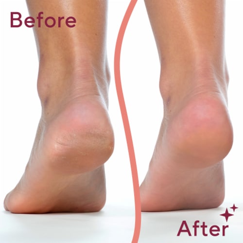 Finishing Touch Flawless Pedi Electric Foot Filer Perspective: right