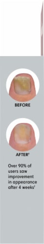 Kroger® Fungal Nail Restoring Formula Perspective: right