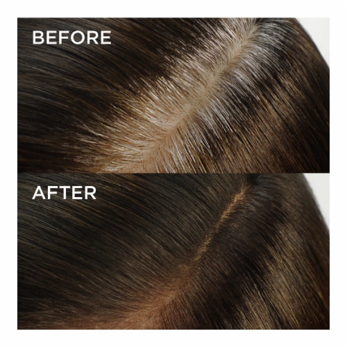 L'Oreal Paris Magic Root Rescue Root Coloring Kit Permanent 5A Medium Ash Brown Perspective: right