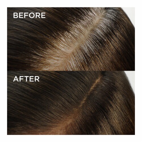L'Oreal Paris Magic Root Rescue Root Coloring Kit Permanent 5A Medium Ash Brown Perspective: right