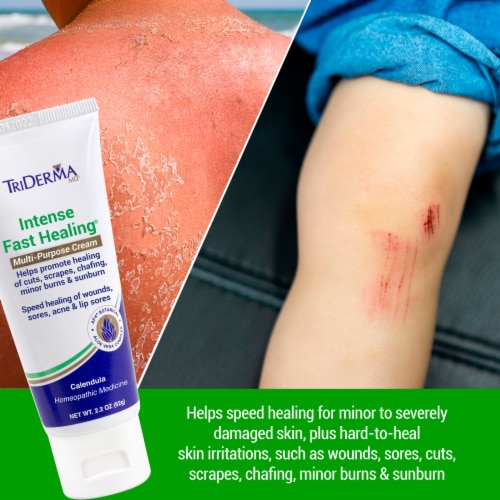TriDerma Intense Fast Healing Multi-Purpose Cream Perspective: right