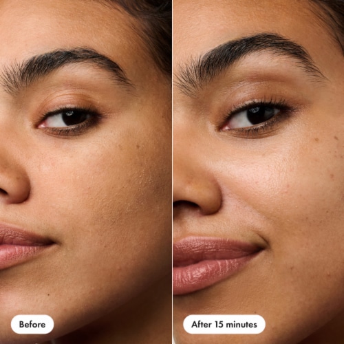 Hero Cosmetics Rescue Patch Post Blemish Skin, 6ct Perspective: right