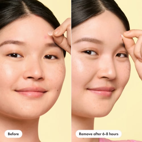 Hero Cosmetics Mighty Patch Invisible+ Mini Patches Perspective: right