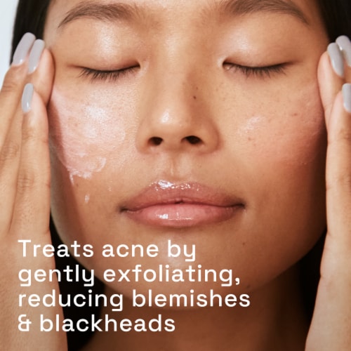 Cetaphil Gentle Clear Pore Clearing Acne Cleanser with 2% Salicylic Acid Perspective: right