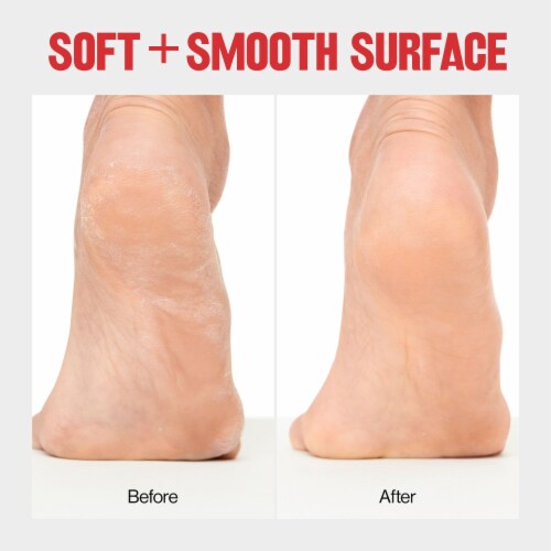 Revlon Callus Remover Foot File with Catcher Perspective: right