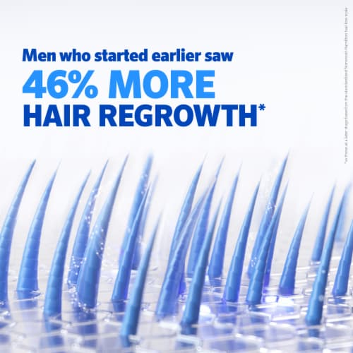 Men s Rogaine 5 Minoxidil Foam Treatment 2.11 oz Fry s Food Stores