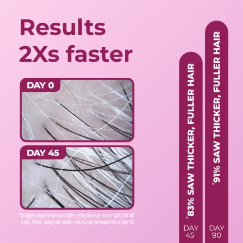 Bosley® MD Revive+ Densifying Foam For Women Perspective: right