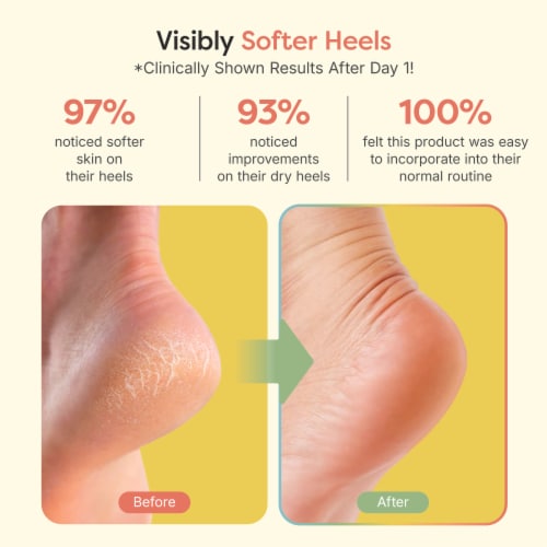 ZenToes Moisturizing Heel Socks to Treat Dry Cracked Heels Regular Fuzzy Fit Select Colors Regular Smith s Food and Drug