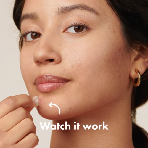 Hero Cosmetics Mighty Patch® Original Pimple Patches Perspective: right