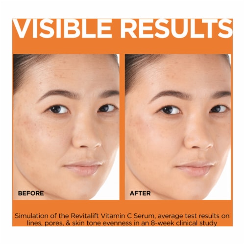 L'Oreal Paris Revitalift 2 percent Pure Vitamin C E Salicylic Acid Serum Perspective: right