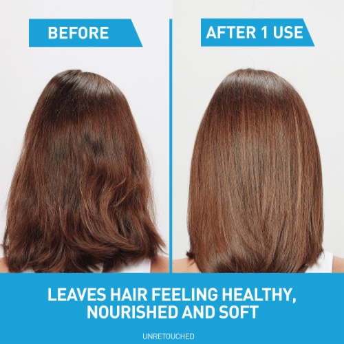CeraVe Hydrating Anti-Dandruff Shampoo, Fragrance Paraben & Sulfate Free Shampoo For All Hair Types Perspective: right