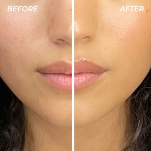MCoBeauty Mega Lip + Skin Balm All-Over Ointment for Dry + Damaged Skin 100% Vegan - Original Perspective: right