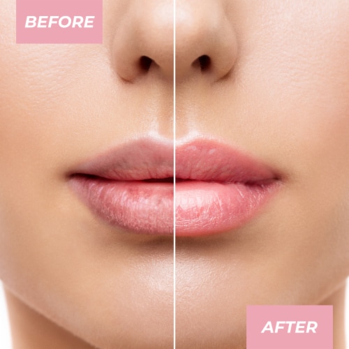 MCoBeauty Glow Up Lip Balm PH Technology + Universal Color Changing Perspective: right