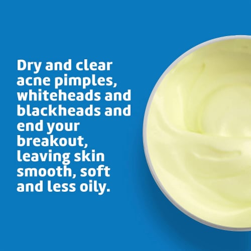 De La Cruz® Maximun Strength Acne Treatment Perspective: top