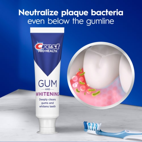 Crest Pro-Health Gum Detoxify Gentle Whitening Anti cavity, Antibacterial Fluoride Toothpaste Perspective: top