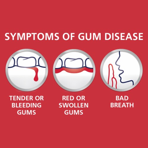 Parodontax Complete Protection Gingivitis Treatment Cavity Prevention Pure Fresh Mint Toothpaste Perspective: top