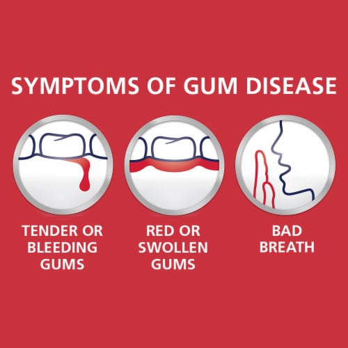Parodontax Gingivitis Bleeding Gums Extra Fresh Toothpaste Perspective: top