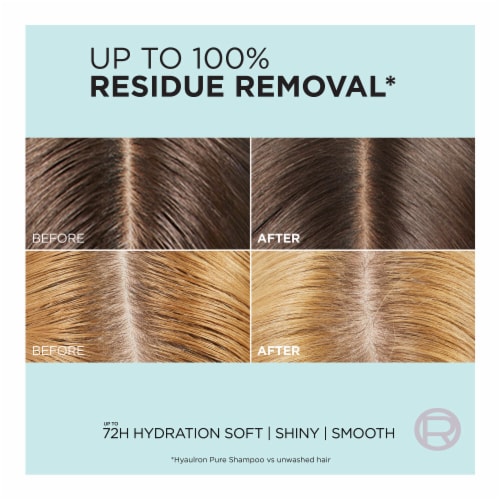 L'Oreal Paris Elvive Hyaluron Plus Pure Conditioner for Oily Hair Perspective: top