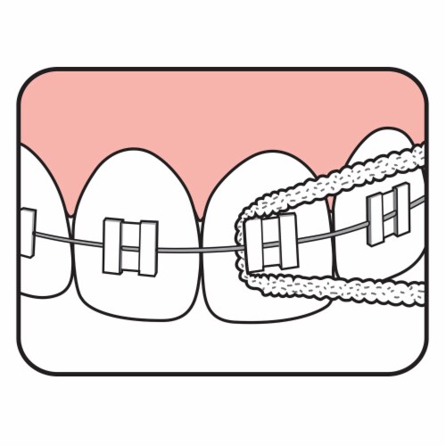TEPE Bridge Implant Dental Floss - Thick, Flexible with Stiff Ends for Braces, 30 Pcs Perspective: top