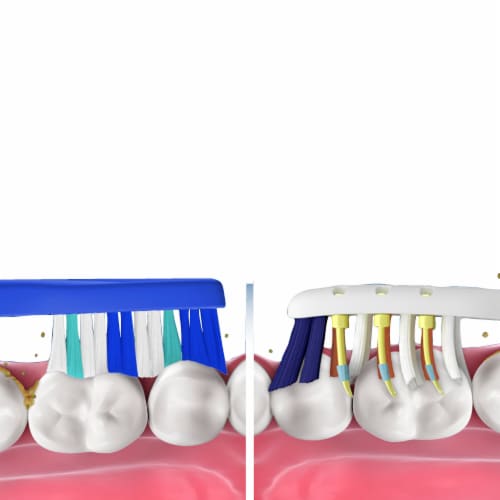 Oral-B Pulsar with Microban Battery Toothbrush Perspective: top