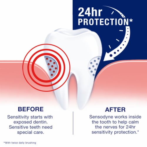 Sensodyne Full Protection Teeth Whitening Sensitive Toothpaste Perspective: top