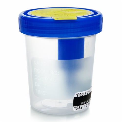 McKesson Urine Collection Cup, Urine Specimen Container with Lid Perspective: top